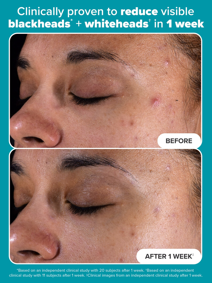 2 bha exfoliating toner pads
