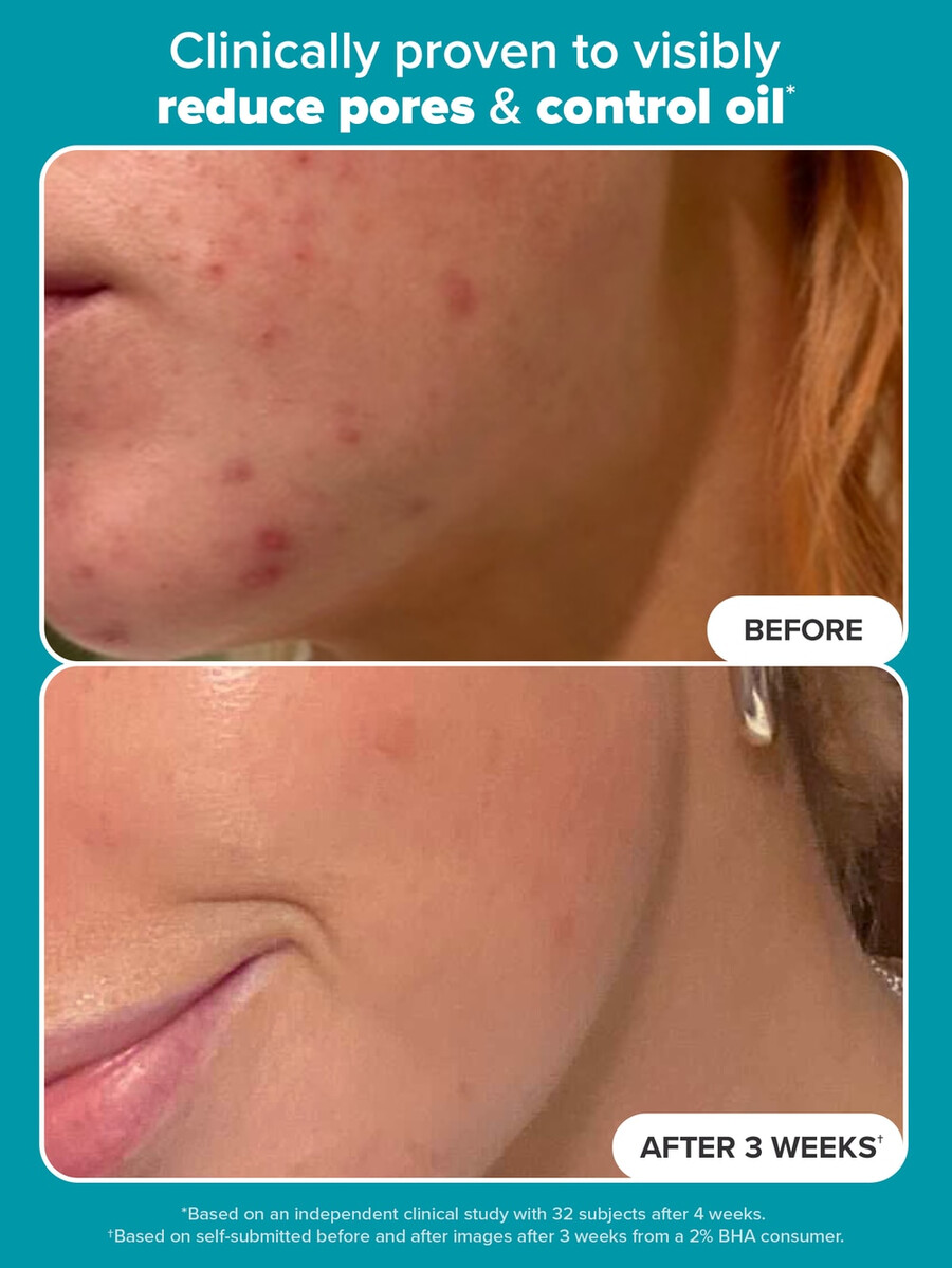 2 bha exfoliating toner pads