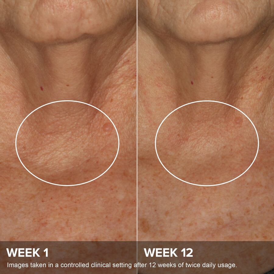 clinical phytoestrogen elasticity renewal body treatment