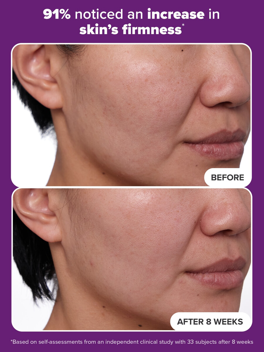 clinical 1 retinol serum treatment for anti-aging