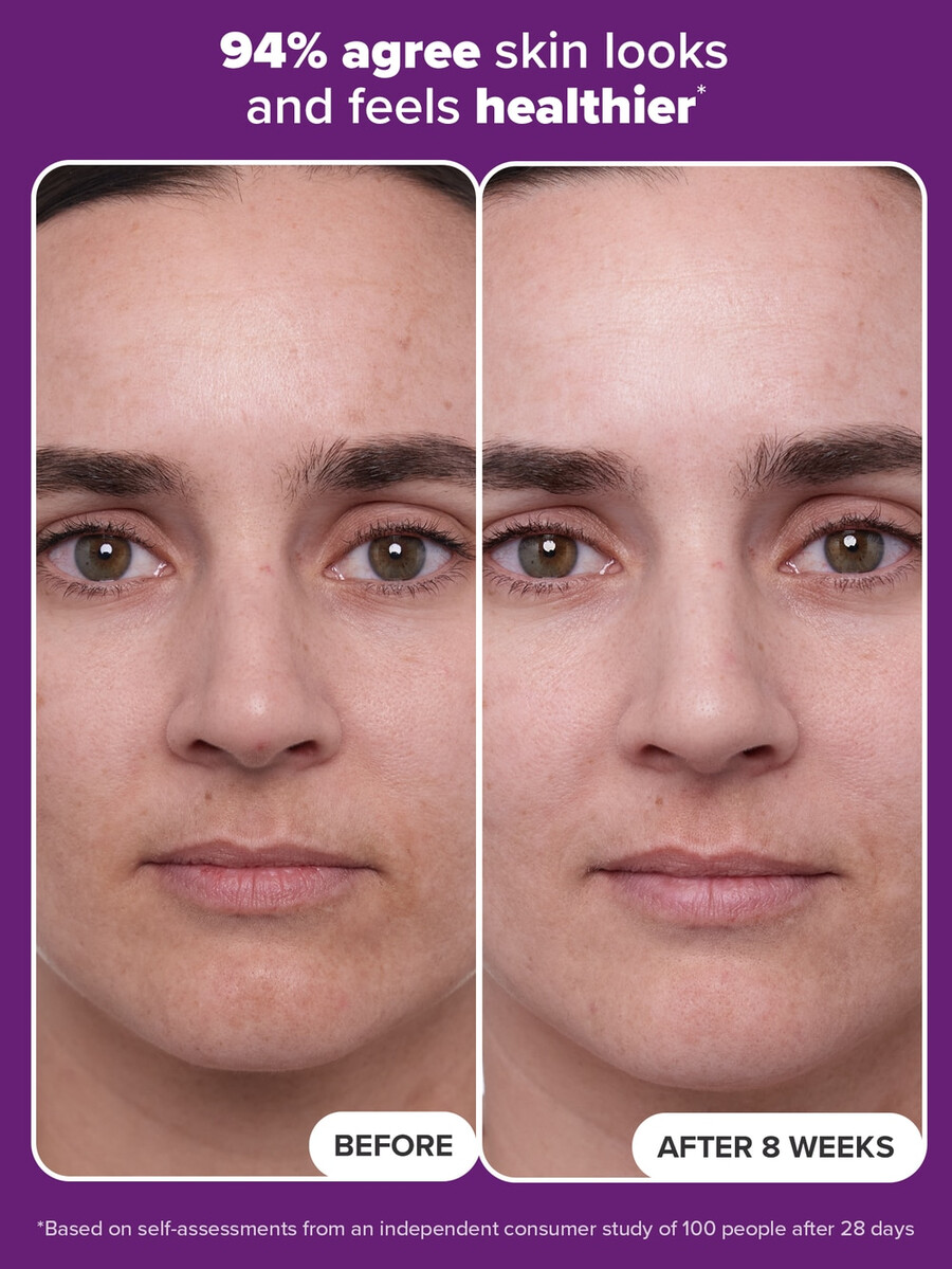 clinical 1 retinol serum treatment for anti-aging