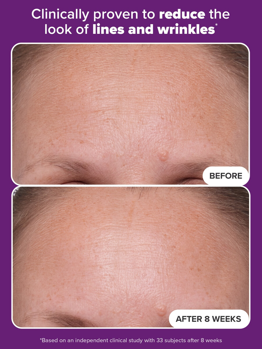 clinical 1 retinol serum treatment for anti-aging